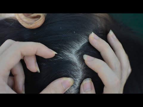 ASMR Scalp Scratching, Melting Scalp Massage Relaxing For Deep Sleep ( Asmr No Talking )