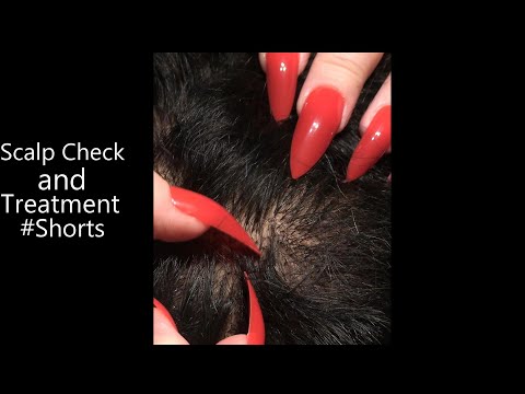 ASMR Scalp Check and Treatment #Shorts