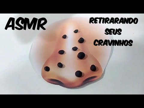 ASMR- RETIRANDO SEUS CRAVINHOS- LIMPEZA DE PELE.
