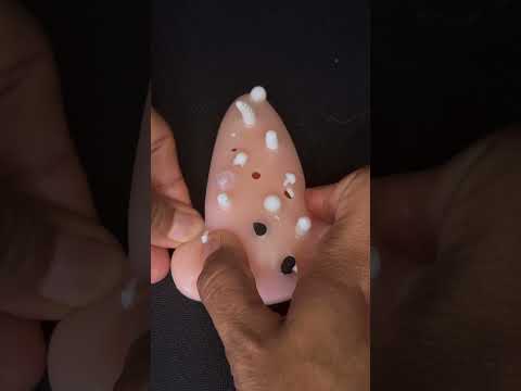 Asmr tirando cravos e espinhas #asmr #asmrsatisfying #asmrskincare