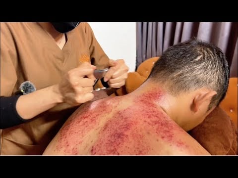 ASMR 🇻🇳 Brutal Neck & Shoulder Therapy in Vietnam | Deep Tissue Massage & Stress Relief