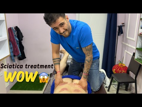 Sciatica pain treatment😱