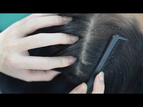 ASMR Scalp Scratching, Hair Parting & Brushing Hair Relaxing For Sleep ( No Talking Asmr )