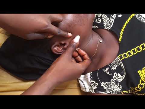 ASMR  ATTENTIVE DEEP EAR CLEANING FOR RELAXATION -WITH BUBBLEGUM