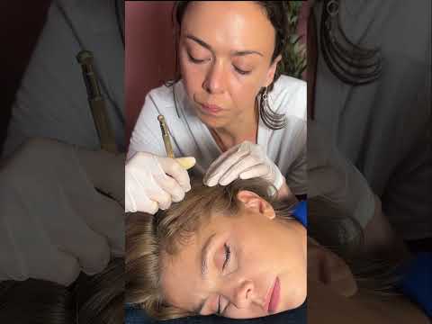Asmr scalp tingles #asmr #asmrsounds #asmrvideo #relax #relaxing #satisfying #hair #sleep #tingles
