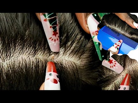 ASMR | Attentive TRIGGERS FOR SLEEP 😮‍💨 Hairplay | Nitpicking~running my fingers through his hair