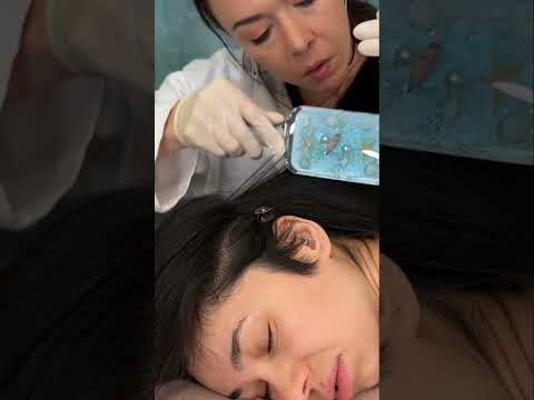 Asmr scalp tingles #asmr #asmrsounds #asmrvideo #relax #relaxing #satisfying #hair #sleep #tingles