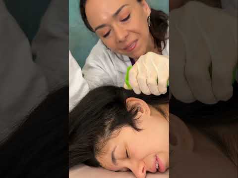 Asmr scalp tingles #asmr #asmrsounds #asmrvideo #relax #relaxing #satisfying #hair #sleep #tingles