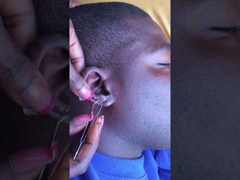 Earwax super Attentive cleaning Asmr #asmrsounds #satisfying #asmr #earwax