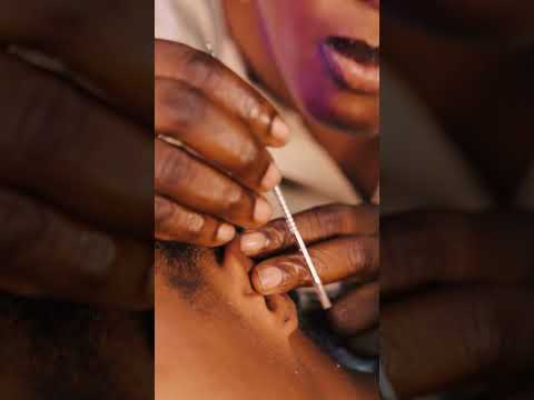 ASMR✨Relaxing Ear cleaning, #mariamsasmr #asmr #scalpscratching #gumcracking #