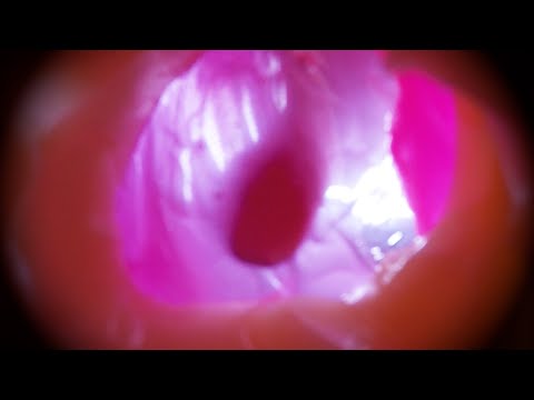 [ASMR] Experience touching the eardrum from inside the ear (silicone ear, No Talking)