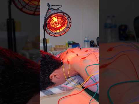 ASMR: Incredible Chinese Electric Acupuncture Chiropractic and Cupping Massage #shorts