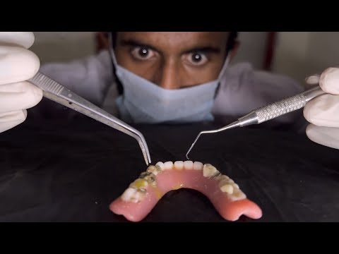 ASMR 🦷 Dentist Cleans Your Teeth!!