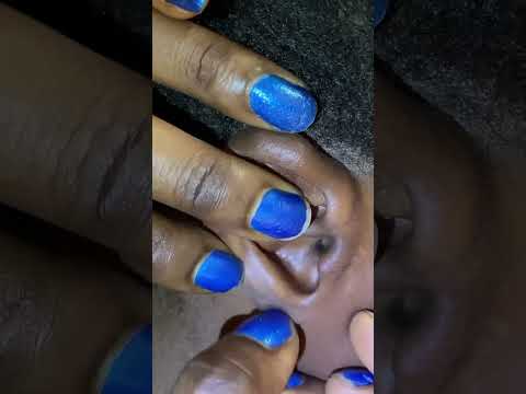 A rare and attentive ear cleaning #satisfying #asmr #sleepsounds #relax #tingling