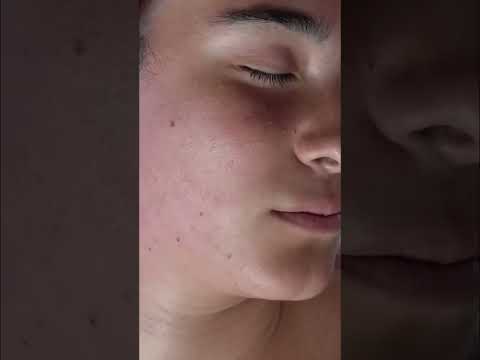 Satisfying Facial Hair Removal ASMR: Watch This Transformation! #shorts