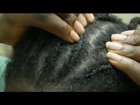 ASMR Fast and Aggressive Scratching Between Braids (upclose dandruff scratching)