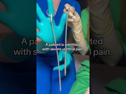 Timely intervention is critical to prevent complications #medicalexam #roleplaynurse #latexglovs
