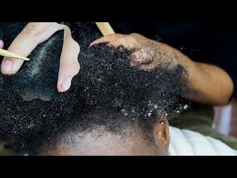 Soothing Sounds Of Scalp Scratching -full video is on MALAIKA ASMR channel #shorts