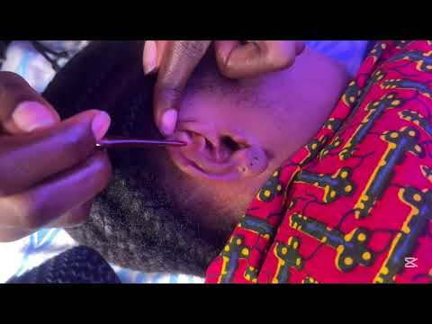 ASMR EAR CLEANING FOR NIGHT SLEEP, TINGLING NITPICKING FOR SLEEP