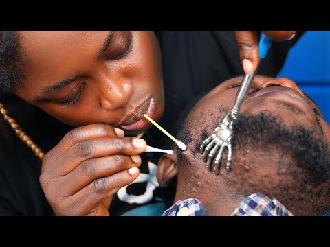 ASMR✨no talking ingrown hair pullout, ,beard scraping,beard scratching,mouth cleansing beard.