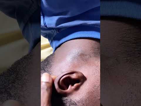 ASMR SUPER ATTENTIVE NITPICKING FOR THOSE WHO WANT TO SLEEP #asmr #earcleaning #nitpicking