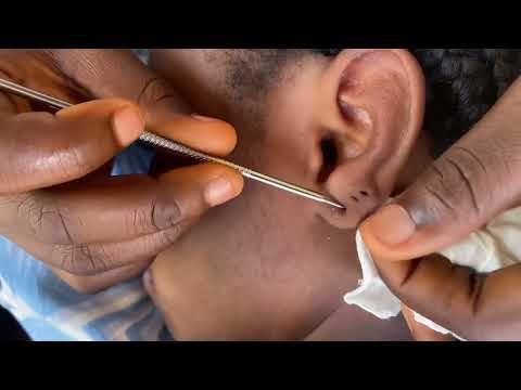 ASMR AGGRESSIVE INTENSE SCALP SCRATCHING AND MASSAGE, EAR MASSAGE