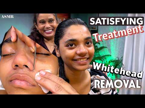 Most Satisfying Blackhead & Whitehead Removal and Deep Relaxing ASMR Facial Massage By Masseuse shin