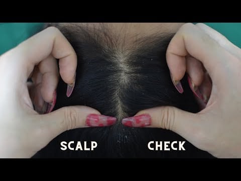 [ ASMR ] 1 Hour Scalp Check, Scalp Scratching, Scalp Treatment Relaxing For Sleep ( No Talking )