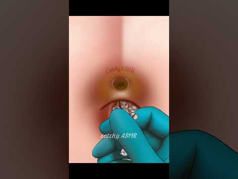 Belly Button Care And Hygiene Routine Animation, Relaxing ASMR Animation, Satisfying ASMR Animation