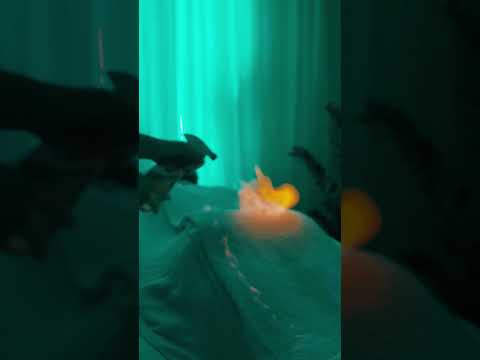 Body Massage & Fire  #realasmr #asmr #massage