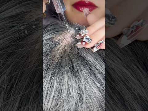 Scalp Care 💆🏻‍♀️ #asmr #relax #visualtingle #relaxing #satisfying #tingles