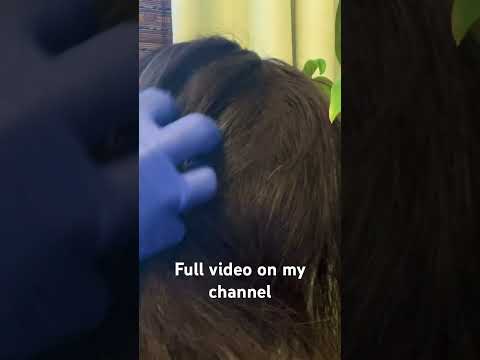 #foryou