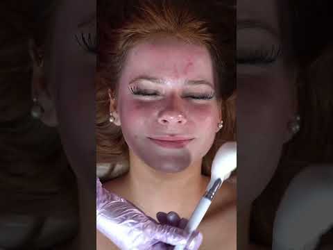 Oxygen Facial vs. Dermaplaning: Ultimate Skin Glow-Up Secret! #shorts