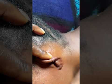 Deep ear cleaning on a real person #asmr #tingling #sleepsounds #satisfying #sleepmusic