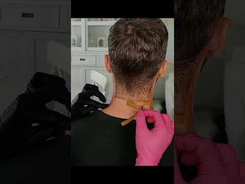 His new neck hairline