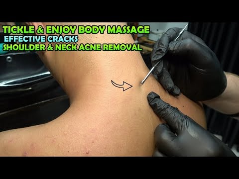 💈ASMR BARBER SHOULDER ACNE REMOVAL TREATMENT + CRACKS + Tickle Chest,Head,Belly,Foot & Body Massage