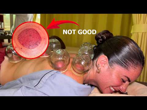 ASMR: I Tried the REAL Chinese FIRE CUPPING with Tuina Massage