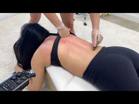 Skin Surprise: Deep Cleanse of Tissue Congestion CRUNCHY BACK CRACKS