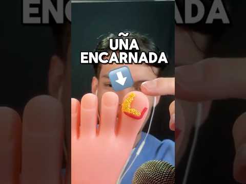 TE QUITO LA UÑA ENCARNADA #ASMR #shorts #asmrsounds #comedia