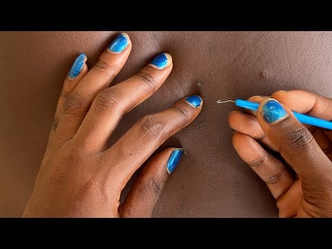 Asmr Real person back nitpicking/ bubble gum