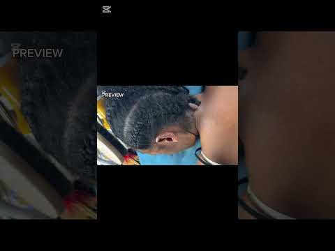 ASMR SATISFYING DEEP EAR NITPICKING CLEANING MASSAGE AND SCALP SCRATCH #asmrtapping