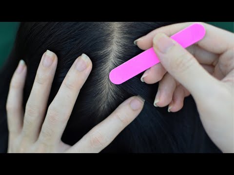 ASMR Scalp Scratching On Real Person Tingling For Relieve Stress, Anxiety, Headache