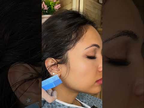 Asmr ear 👂 exam #asmr #relax #relaxing #asmrsounds #asmrvideo #tingles #medical #satisfying #sleep