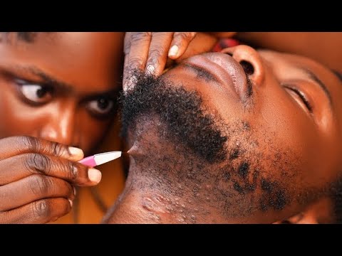 ASMR ✨Intense beard scratching, long nails,  Deep ear cleaning, ingrown hair pulling 