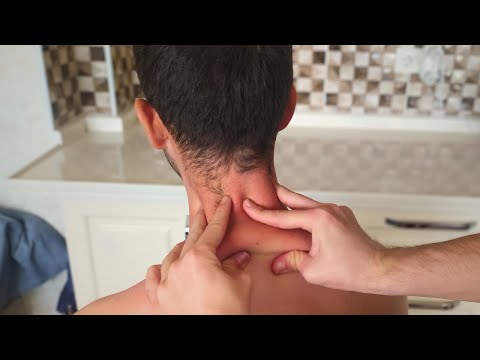 Ultimate Neck Massage for Instant Relief! 💆‍♂️✨ Relaxing ASMR Therapy - ASMR