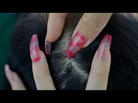 ASMR Relaxing Scalp Check For Sleep / Big Flakes / Long Nails / Scratching / No Talking