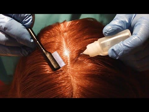 ASMR Scalp Check and Treatment (Lice Check, Scalp Massage, Lice Comb, Whispering) Medical Roleplay