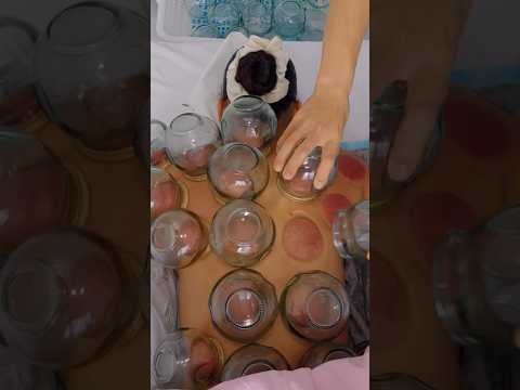 ASMR: Intense Chinese Body Therapy Massage with Fire Cupping #shorts