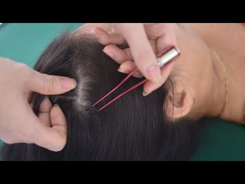 ASMR Scalp Scratching With Tweezer, Real Person Hair Parting, Hair Play  For Relieve Stress, Anxiety