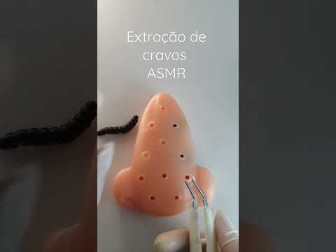 ASMR Extração de cravos | #shorts #asmrbr